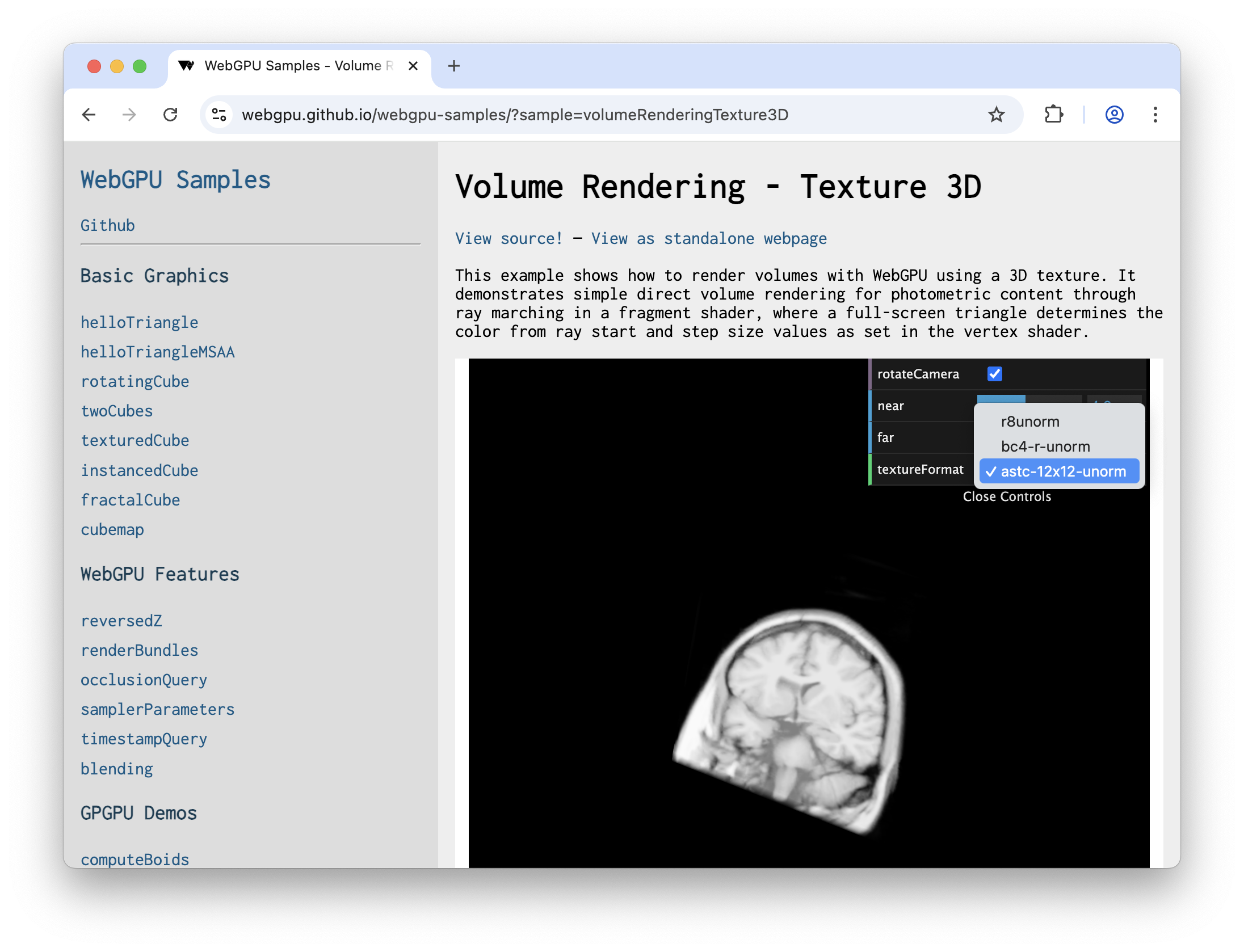 Skanowanie mózgu w 3D renderowane za pomocą WebGPU.